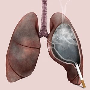 タバコを吸うことによる、肺への影響